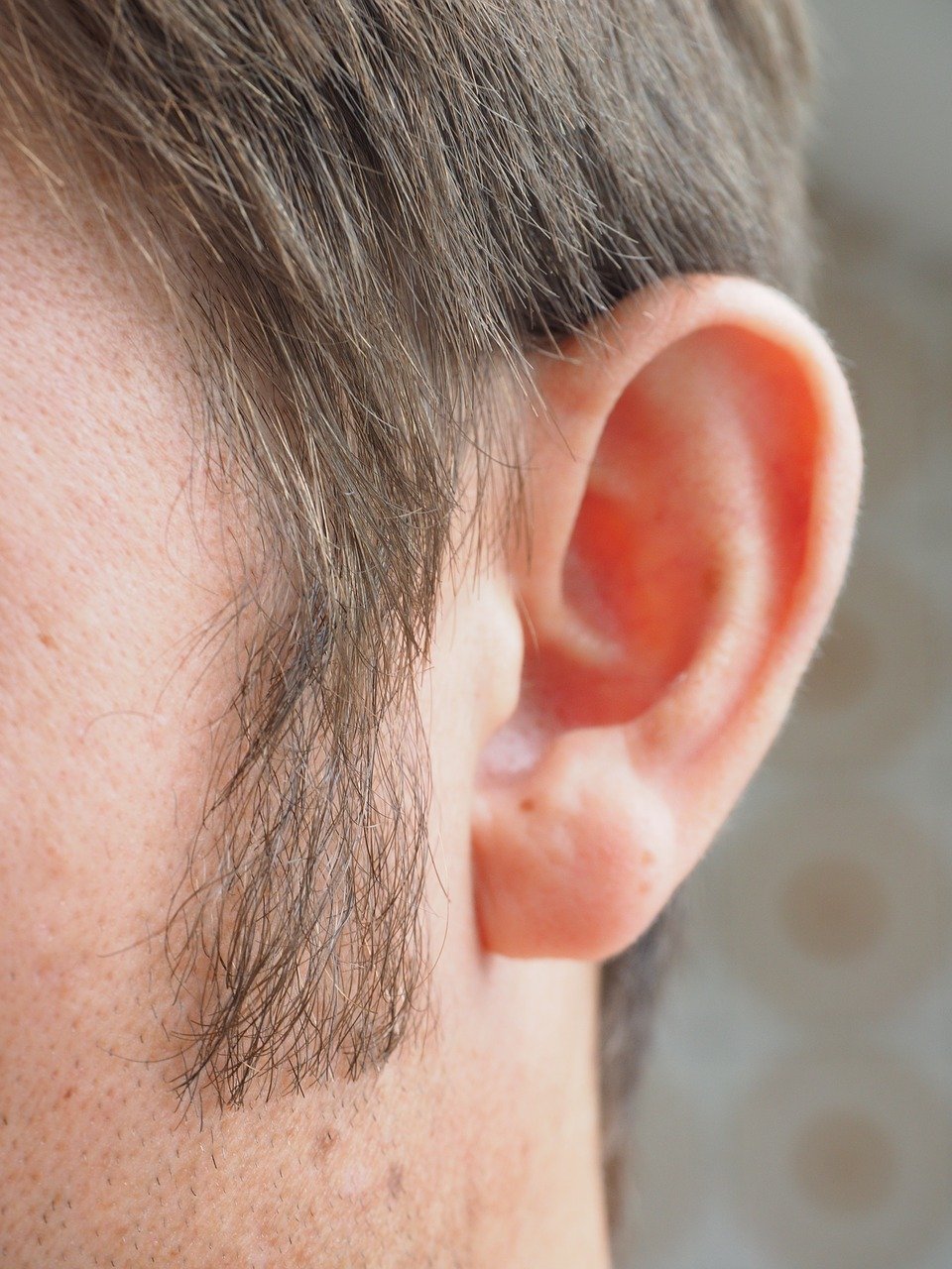 Sideburn